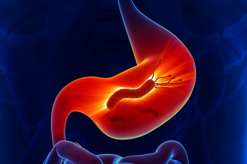 La bactérie Helicobacter pylori (H. pylori) : Comprendre l'infection et ses symptômes